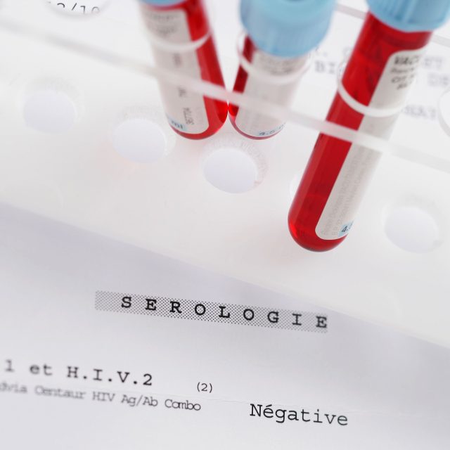 Test HIV  (ilustrační foto) | foto: Fotobanka Profimedia