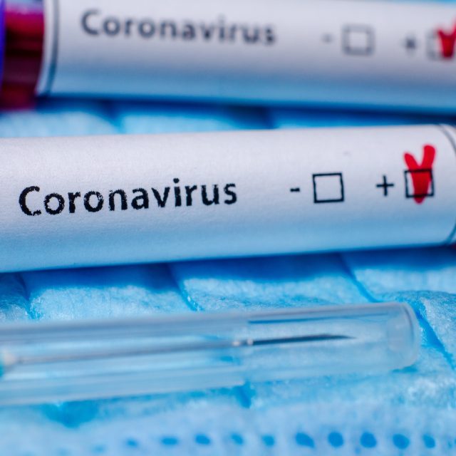 Koronavirus,  vzorek,  test,  laboratoř,  odběr krve,  Covid-19,  nákaza,  ilustrační | foto: Fotobanka Profimedia