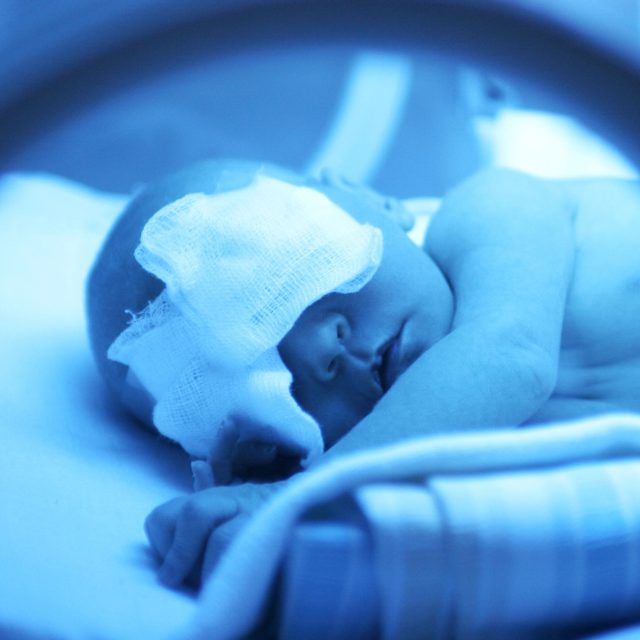 Novorozenec v inkubátoru | foto: Profimedia