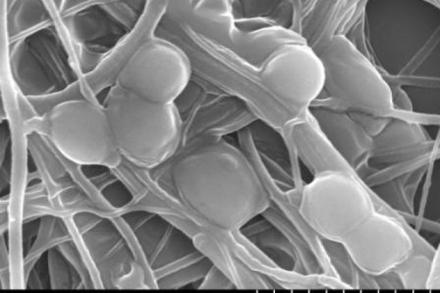 Kvasinkové buňky imobilizované v síti nanovláken s produkcí mimobuněčné hmoty | foto: Prof. Vladimír  Jirků,  VŠCHT . Výzk. centrum ARTEC