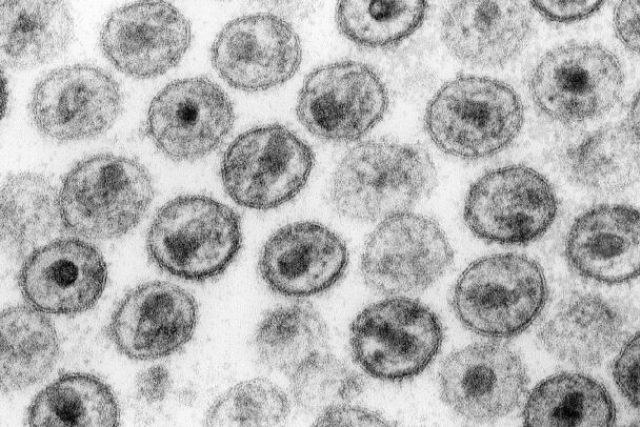 Virus HIV pod elektronovým mikroskopem | foto: licence Public Domain,  volné dílo