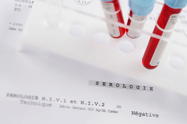 Test HIV  (ilustrační foto) | foto: Fotobanka Profimedia