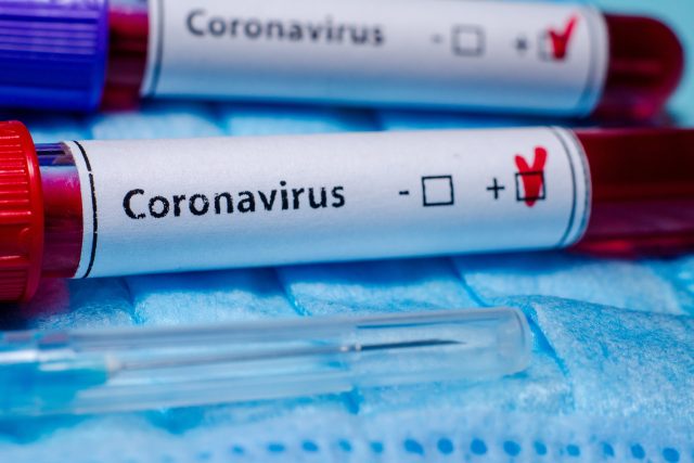 Testy na koronavirus  (ilustr. obr.) | foto: Fotobanka Profimedia