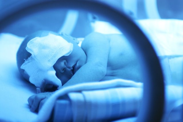 Novorozenec v inkubátoru | foto: Profimedia