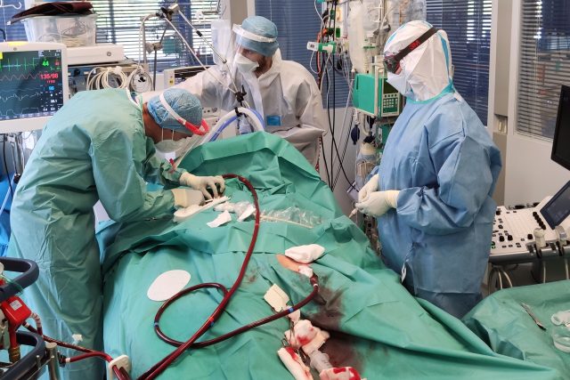 KAPIM v Masarykově nemocnici v Ústí nad Labem poskytuje pacientům s těžkou formou COVID-19 špičkovou péči. Takto například vypadá extrakorporální membránová oxygenace  (ECMO) | foto: Krajská zdravotní