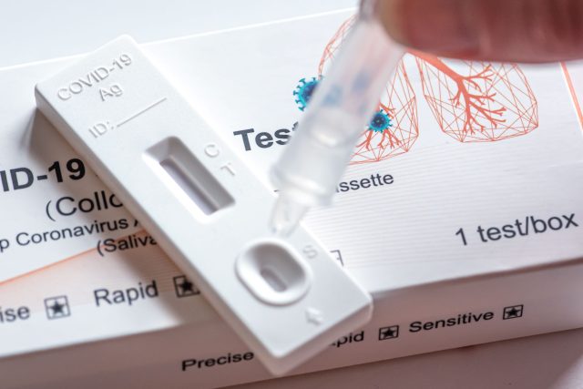Antigenní test | foto: Shutterstock