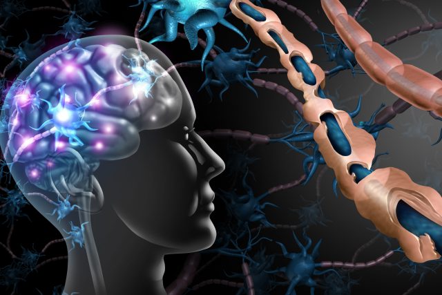Porucha nervového systému  (ilustrační foto) | foto: Fotobanka Profimedia
